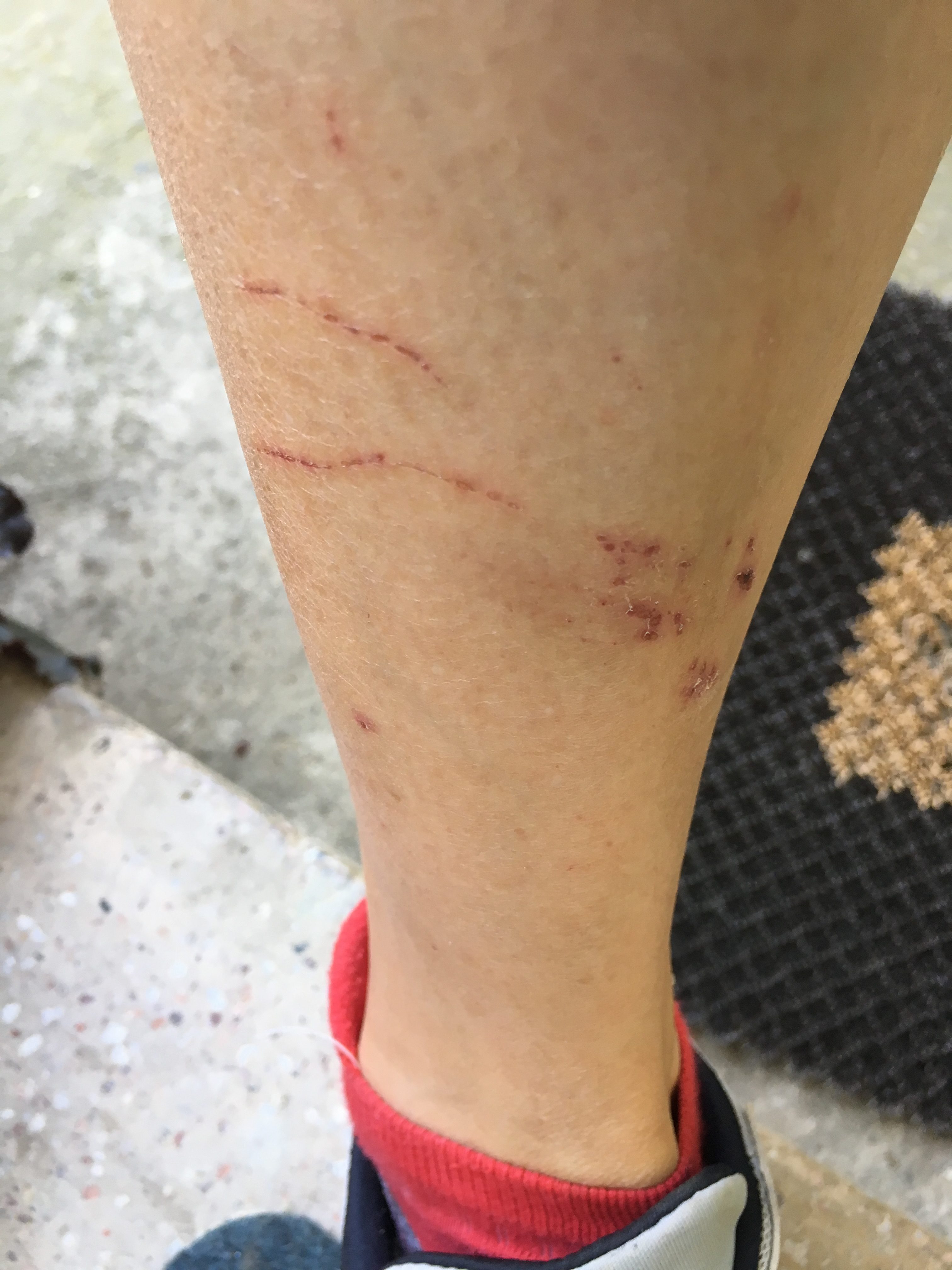 Battle scars